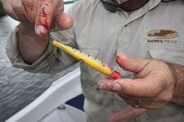 Ouch!! Fish hook injuries - Fishing World Australia